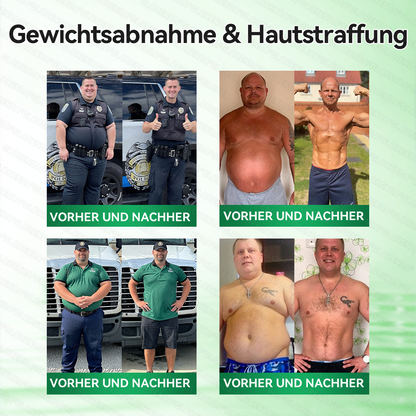 🇩🇪𝐐𝐮𝐚𝐥𝐢𝐭ä𝐭𝐬𝐠𝐞𝐩𝐫ü𝐟𝐭 & 𝐕𝐞𝐫𝐢𝐟𝐢𝐳𝐢𝐞𝐫𝐭 👩‍⚕️💃𝑮𝑳𝑶𝐑𝐄𝐍𝐃𝘼®𝙈𝙤𝙧𝙞𝙣𝗴𝗮 · 𝗕𝗲𝗿𝗯𝗲𝗿𝒊𝒏 × 𝑵𝘼𝘿+ 10-𝙞𝙣-𝟏 𝐀𝐝𝐯𝐚𝗻𝗰𝗲𝗱 𝗡𝗮𝙣𝙤 𝙈𝙞𝙠𝙧𝐨𝐧𝐚𝐝𝐞𝐥-𝐏𝐚𝒕𝒄𝗵(𝐍𝐮𝐫 𝐞𝐢𝐧𝐦𝐚𝐥 𝐭ä𝐠𝐥𝐢𝐜𝐡, 𝐬𝐢𝐜𝐡𝐭𝐛𝐚𝐫𝐞 𝐕𝐞𝐫ä𝐧𝐝𝐞𝐫𝐮𝐧𝐠𝐞𝐧 𝐢𝐧 𝟕 𝐓𝐚𝐠𝐞𝐧) ✅ 𝐅ü𝐫 𝐅𝐞𝐭𝐭𝐥𝐞𝐢𝐛𝐢𝐠𝐤𝐞𝐢𝐭, 🅛🅞🅞🅢🅔 🅢🅚🅘🅝, 𝐃𝐢𝐚𝐛𝐞𝐭𝐞𝐬, 𝐒𝐜𝐡𝐥𝐚𝐟𝐚𝐩𝐧𝐨𝐞, 𝐆𝐞𝐥𝐞𝐧𝐤𝐩𝐫𝐨𝐛𝐥𝐞𝐦𝐞 𝐮𝐧𝐝 𝐦𝐞𝐡𝐫